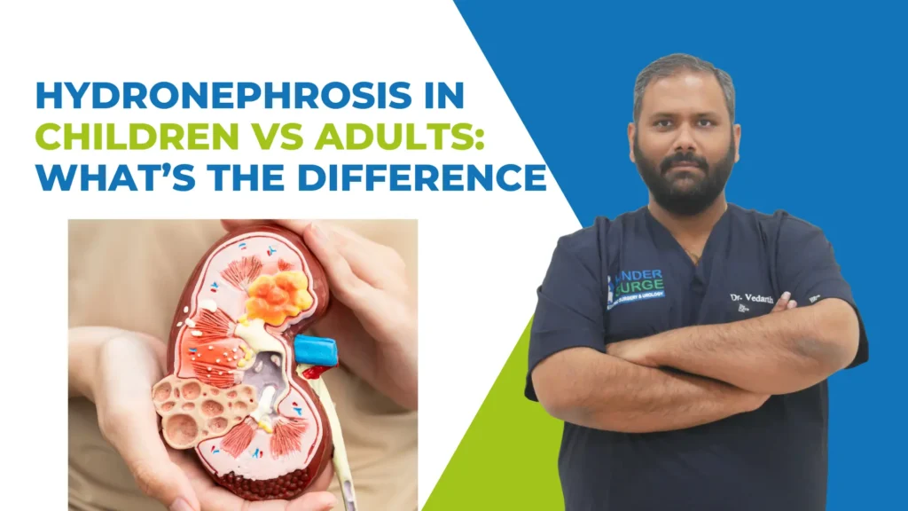 Best Doctors For Hydronephrosis Treatment In Bangalore